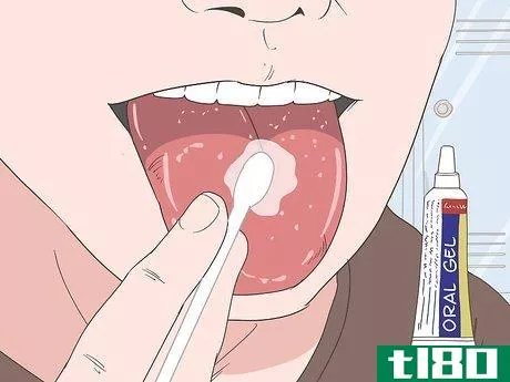 Image titled Heal Your Tongue After Eating Sour Candy Step 3