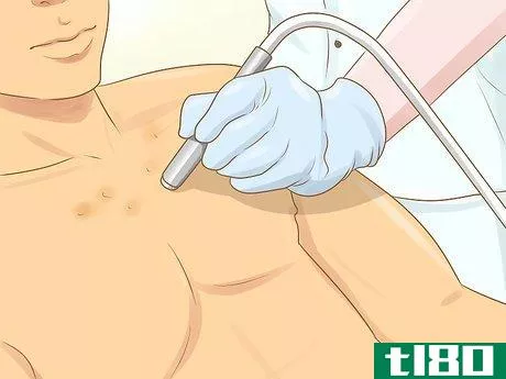 Image titled Get Rid of Acne Scars on Your Chest Step 3