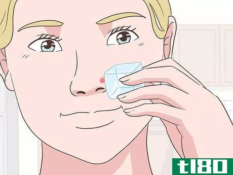 Image titled Get Rid of a Pimple Step 9