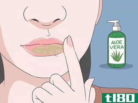 Image titled Get Rid of a Cold Sore with Home Remedies Step 3
