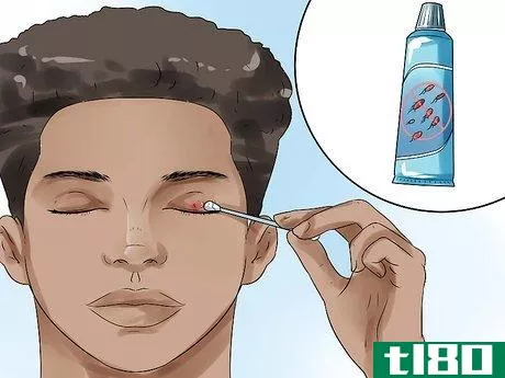 Image titled Get Rid of a Stye Step 4