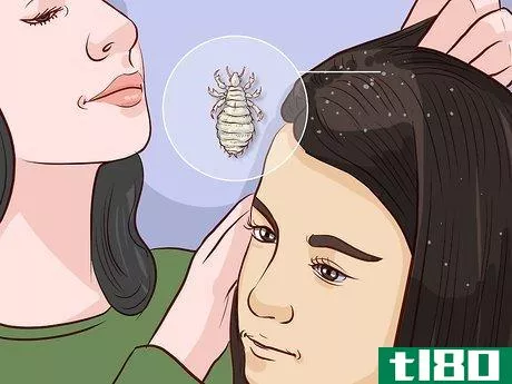 Image titled Get Rid of Lice Step 1