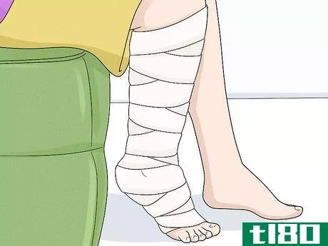 Image titled Identify Lymphedema Step 14