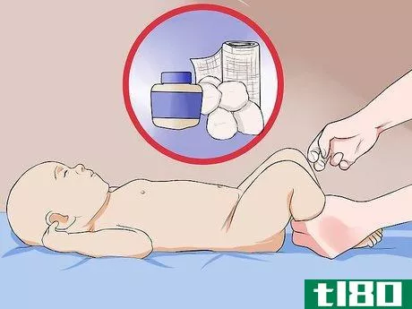 Image titled Have a Safe Circumcision for Your Son Step 13