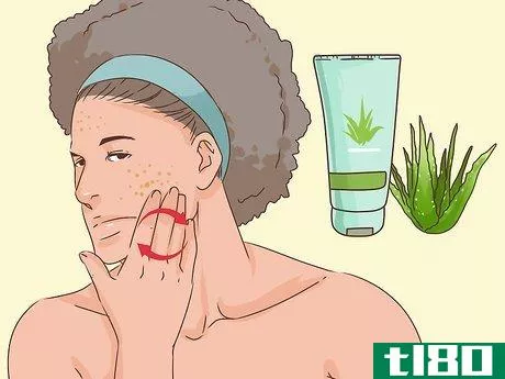Image titled Get Rid of a Popped Pimple Overnight Step 9