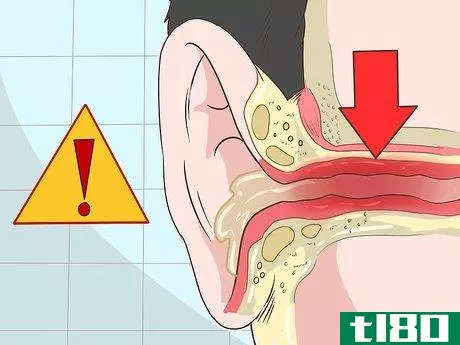 Image titled Get Rid of Ear Wax Step 1