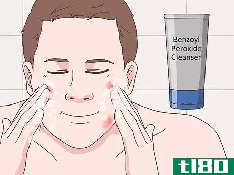 Image titled Get Rid of Acne Cysts Fast Step 8