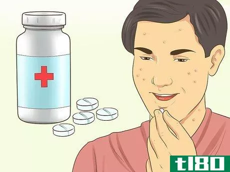 Image titled Know if You Need a Prescription Acne Treatment Step 10