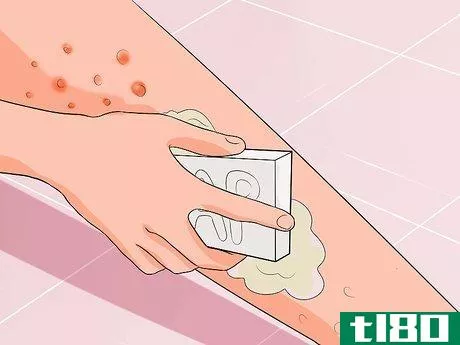 Image titled Get Rid of a Rash from Nair Step 9