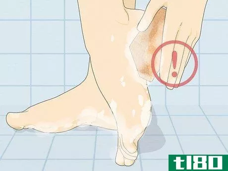 Image titled Heal Cracked Skin Step 14
