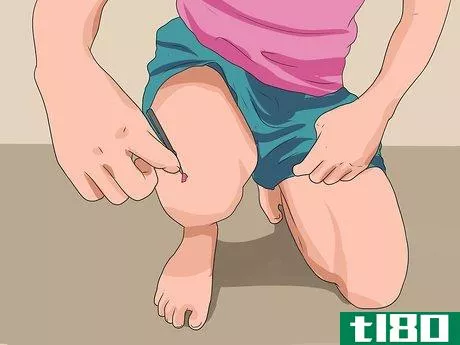 Image titled Heal a Skinned Knee Step 6