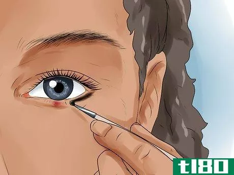 Image titled Get Rid of a Stye Step 11