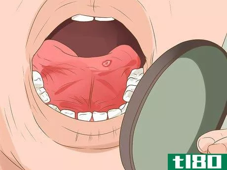 Image titled Heal a Bitten Tongue Step 3