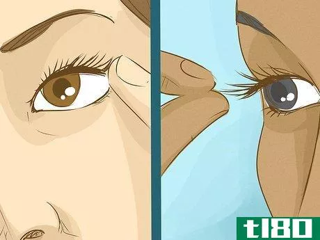 Image titled Get an Eyelash Out of Your Eye Step 7