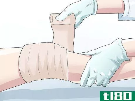 Image titled Know if You Have a Baker's Cyst Step 11