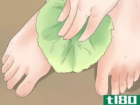 Image titled Get Rid of Gout when Pregnant Step 5