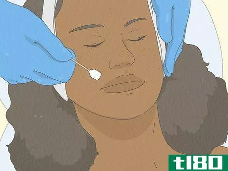 Image titled Get Rid of Dark Spots from Acne Step 2