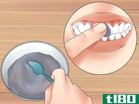 Image titled Get Rid of White Spots on Teeth Step 2