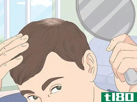 Image titled Know if You Have Male Pattern Baldness Step 1