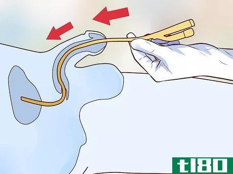 Image titled Insert a Catheter Step 9