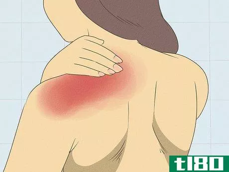 Image titled Heal a Pulled Trapezius Muscle Step 4