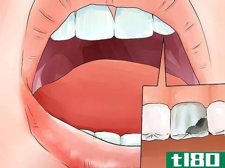Image titled Identify if You Have Sensitive Teeth Step 7