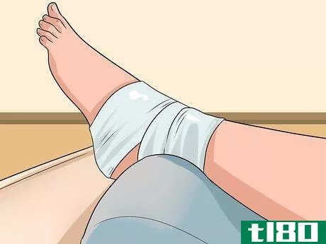 Image titled Know if You've Sprained Your Ankle Step 14