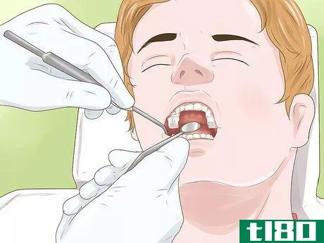 Image titled Know if Your Dental Fillings Need Replacing Step 12