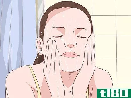 如何治愈痤疮痂(heal acne scabs)