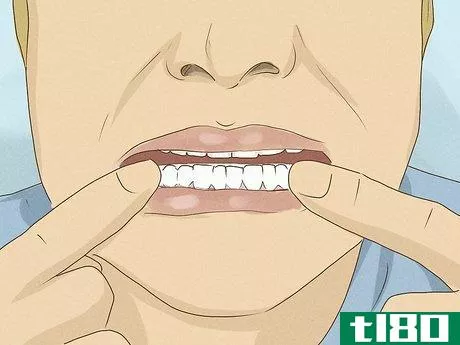 Image titled Get Whiter Teeth at Home Step 3