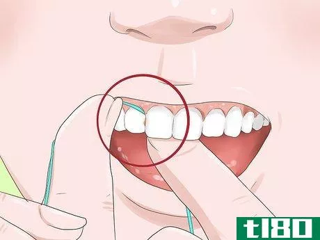 Image titled Know if Your Dental Fillings Need Replacing Step 6