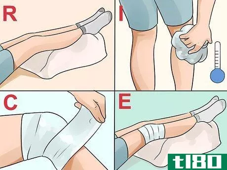 Image titled Get Rid of a Cyst Step 5