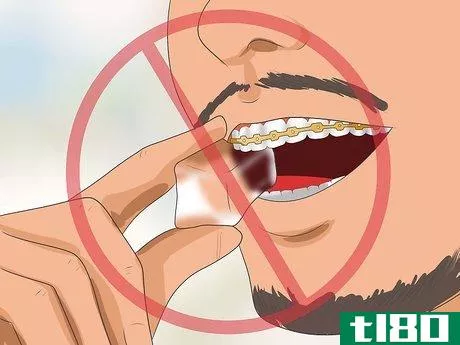 Image titled Get Your Braces off Faster Step 10