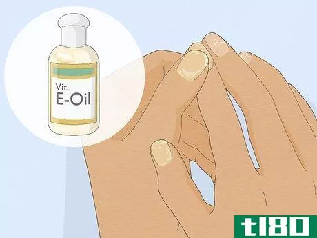 Image titled Get Rid of White Spots on Your Nails Step 1