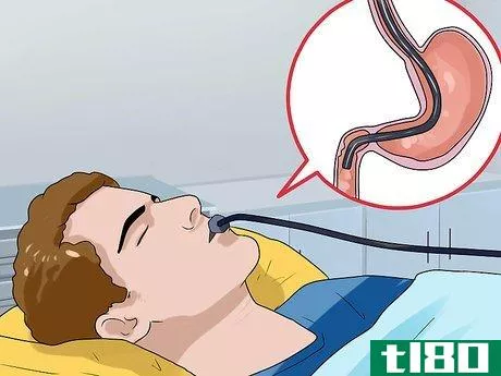 Image titled Know if You Have Esophagitis Step 19
