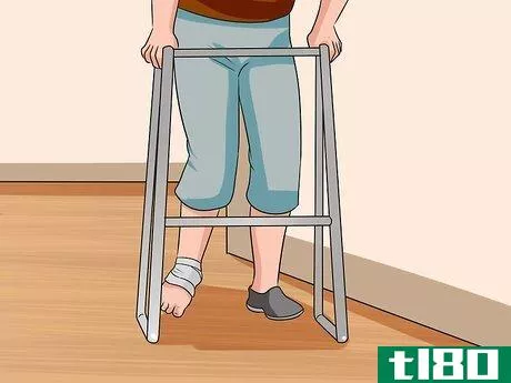 Image titled Know if You've Sprained Your Ankle Step 16