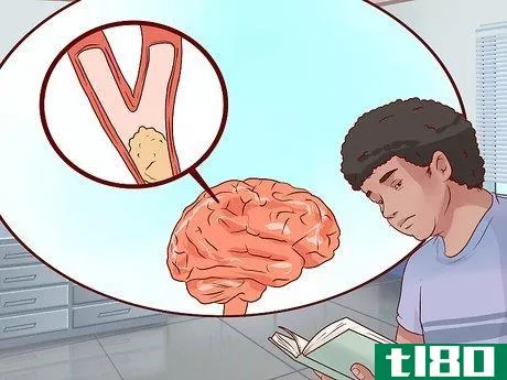 Image titled Identify Stroke Symptoms As a Young Adult Step 13