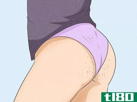 Image titled Get Rid of Acne on the Buttocks Step 2