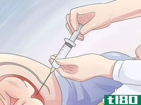 Image titled Increase Amniotic Fluid Step 2