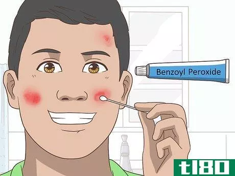 Image titled Get Rid of Acne Cysts Fast Step 10