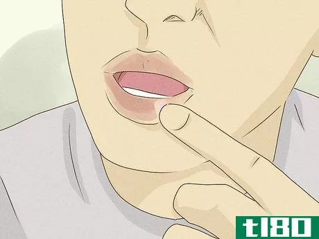 Image titled Heal Lips After Biting Them Step 2