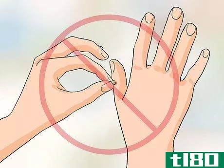 Image titled Get Rid of Warts on Fingers Step 10
