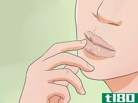 Image titled Get Big Lips Step 1