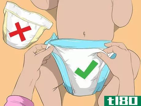 Image titled Identify and Treat Different Types of Diaper Rash Step 9