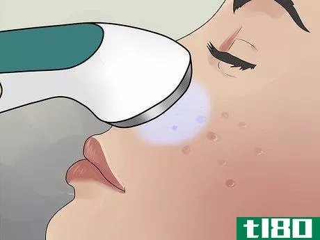 Image titled Get Rid of Cystic Acne Scars Step 11