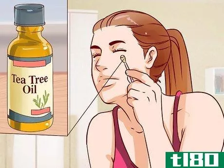 Image titled Get Rid of a Hard Pimple Step 1