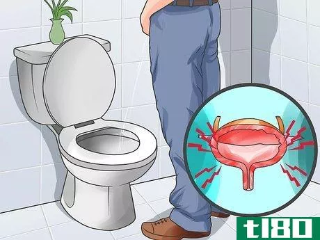 Image titled Know if You Have Prostate Cancer Step 6