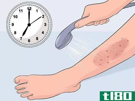 Image titled Get Rid of a Rash from Nair Step 2