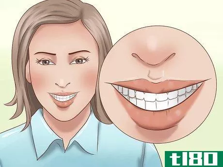 Image titled Have the Perfect Smile Step 5
