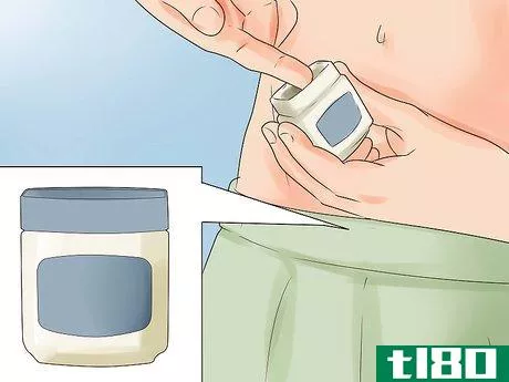 Image titled Get Rid of Pubic Lice Step 13